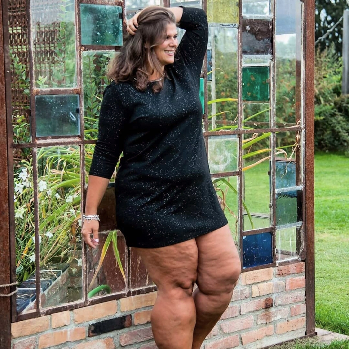 Bloggerin Katy zeigt ihre nackten Beine